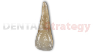 Aged maxillary central incisor (8)