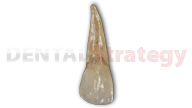 Aged maxillary lateral incisor (7)