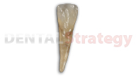 Aged mandibular central incisor (25)