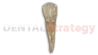 Aged mandibular first premolar (28)