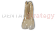 Aged maxillary first molar (3)