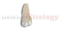 Young maxillary third molar (16)