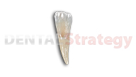 Young mandibular lateral incisor (23)