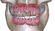 Morphology of gums